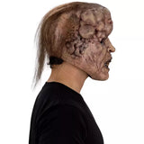 Mascara Tumoral Diceased